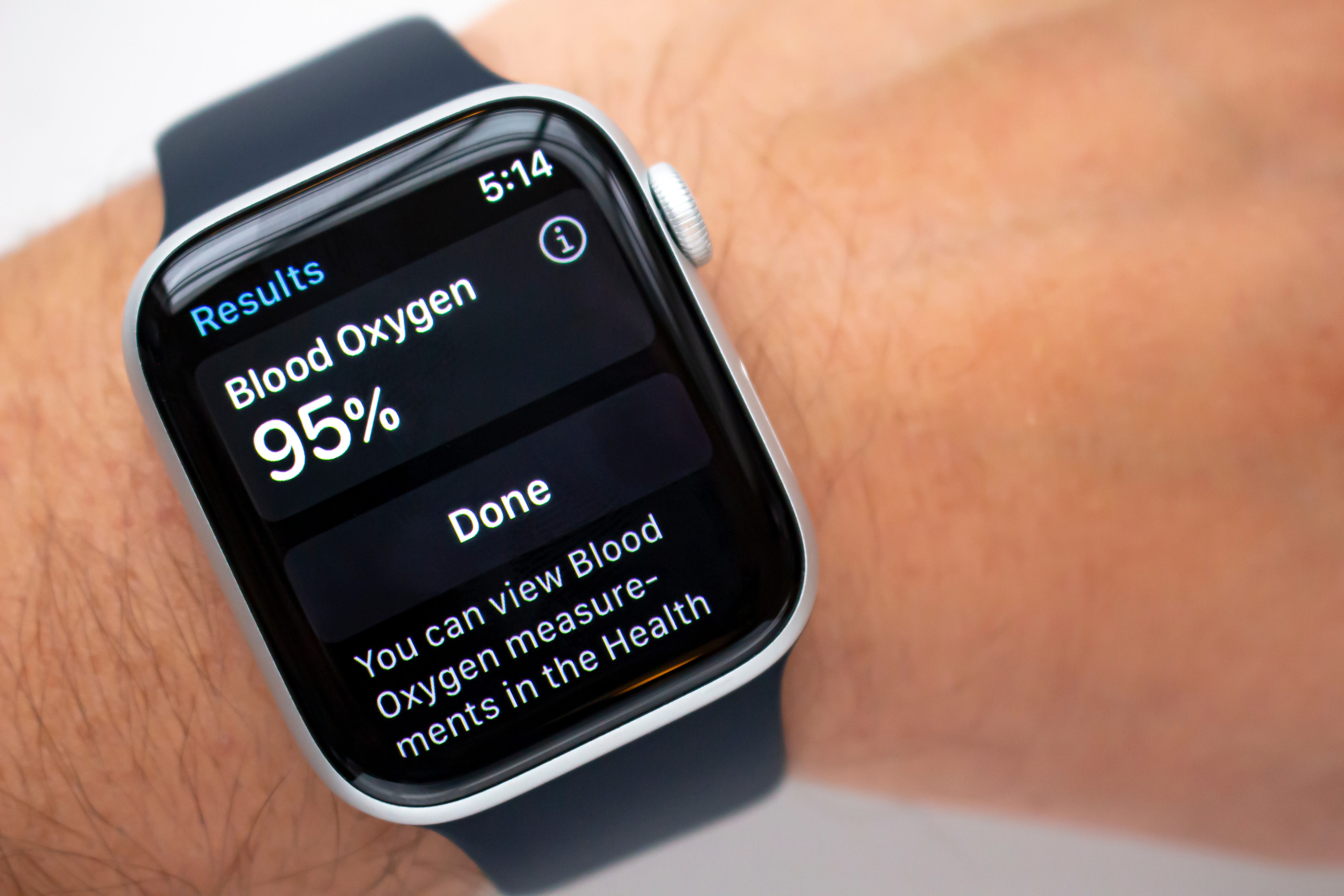 Apple setzt Smartwatch-Verkauf aus nach Patentstreit mit Masimo und hofft nun auf Einmischung des US-Präsidenten