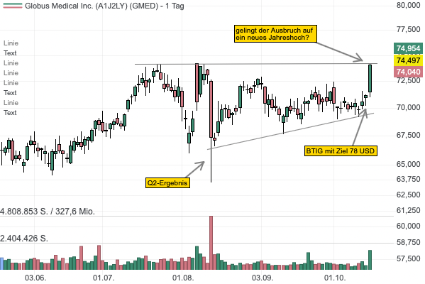 Globus Medical setzt auf robotergestützte Operationen - Aktie vor Ausbruch auf Jahreshoch! 